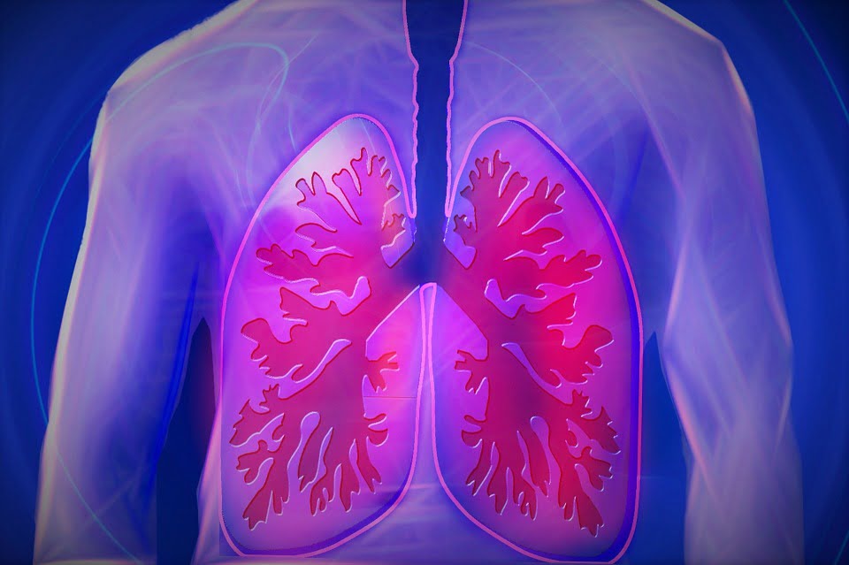 Mesothelioma
